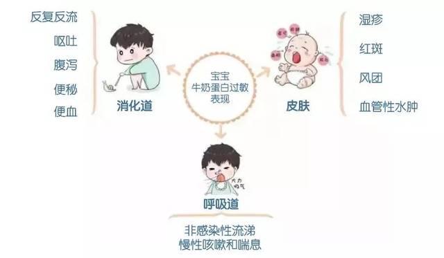 纽瑞优羊奶粉：宝宝牛奶蛋白过敏怎么办？聪明妈妈用这招